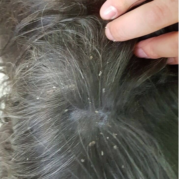 cho-bi-nam-da-chua-tri-dut-diem-lieu-trinh-chuyen-sau-tai-phong-kham-pet-joy